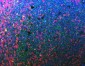 Anti-CD20 Antibody Picoband™ (monoclonal, 4D11)